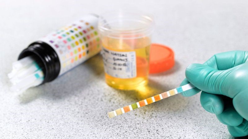 Synthetic Urine Bag Lanesville NY 12450